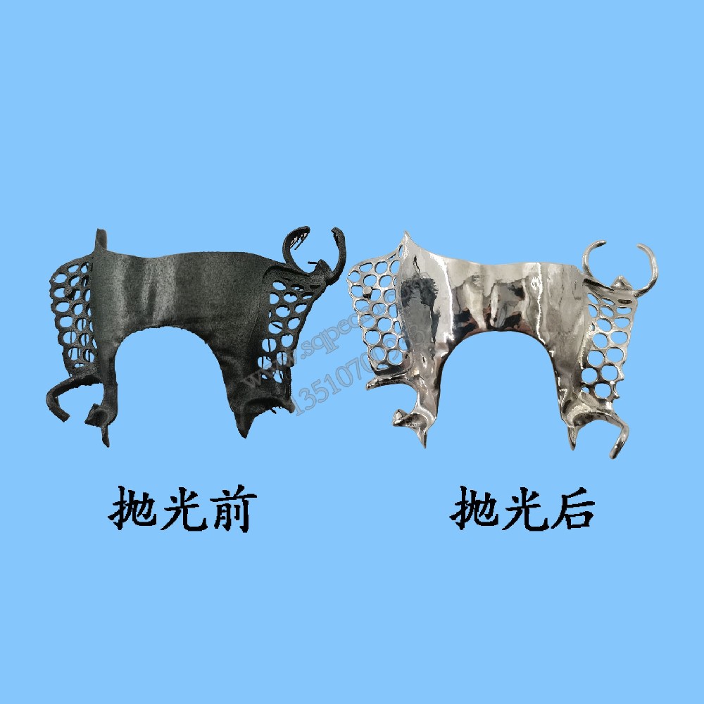 3d打印牙托